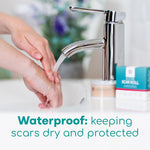 Medical Grade Silicone Scar Tape for Acne Management