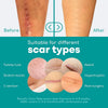 Medical Grade Silicone Scar Tape for Acne Management